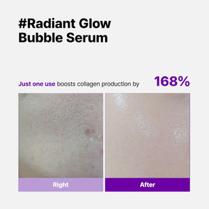 [Skinego] Super Glow Deep Collagen Bubble Serum 70ml