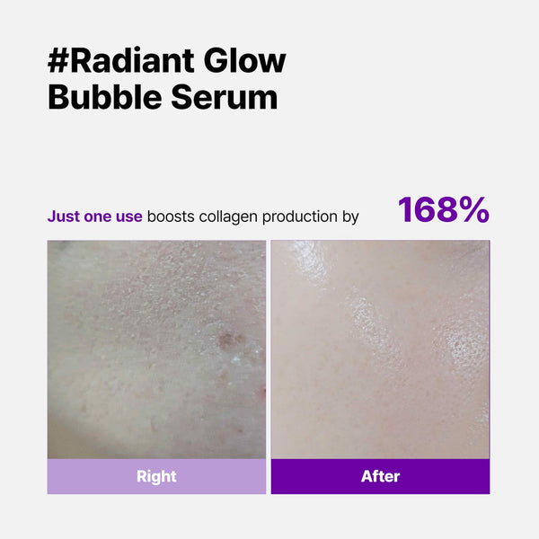 [Skinego] Super Glow Deep Collagen Bubble Serum 70ml